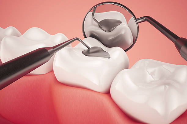 Oral checkup with mirror